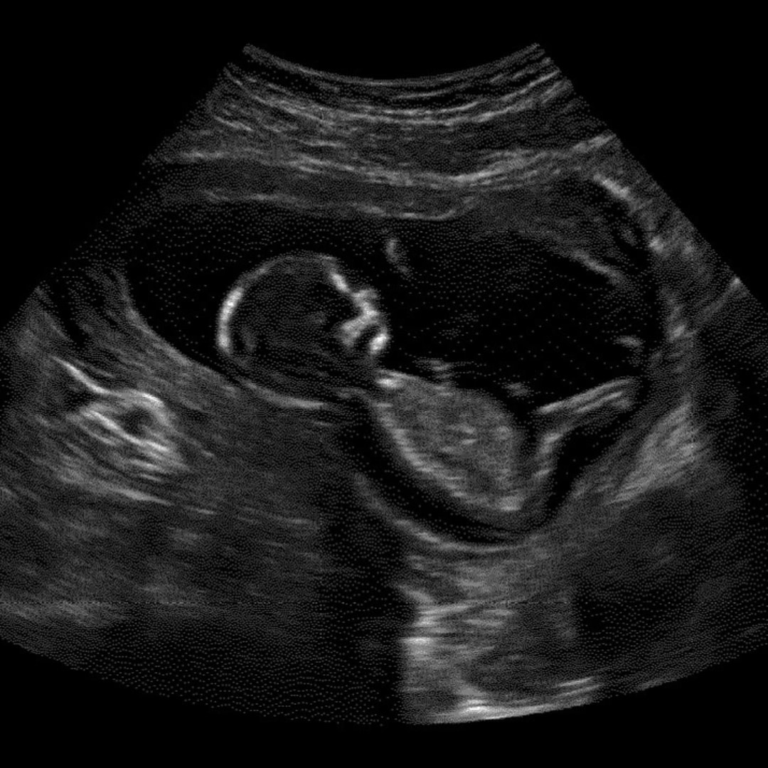 Photo shared by Morgan for their Babylist baby registry.