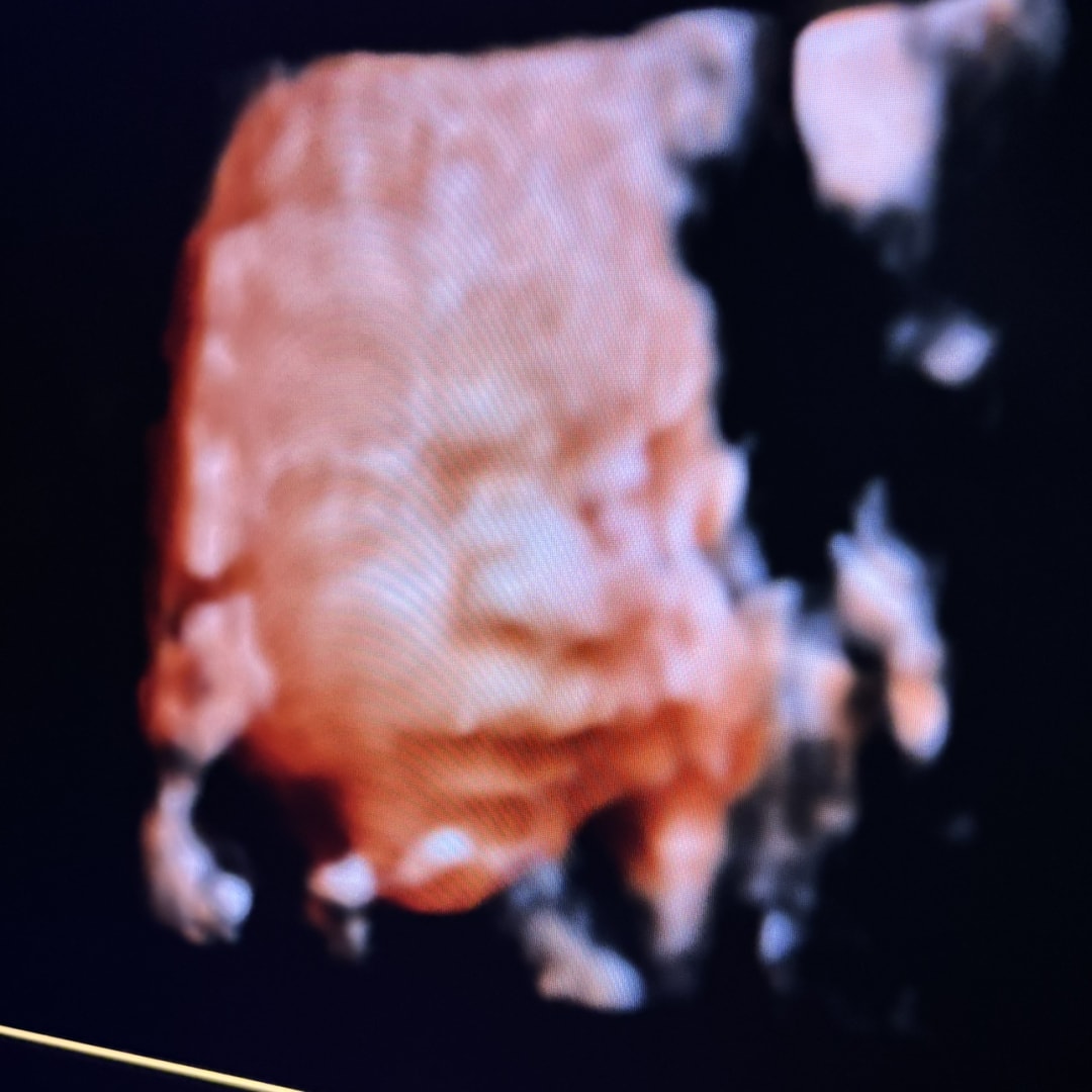 Photo shared by Sierra for their Babylist baby registry.