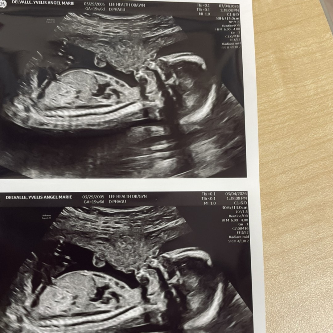 Photo shared by Yvelis for their Babylist baby registry.
