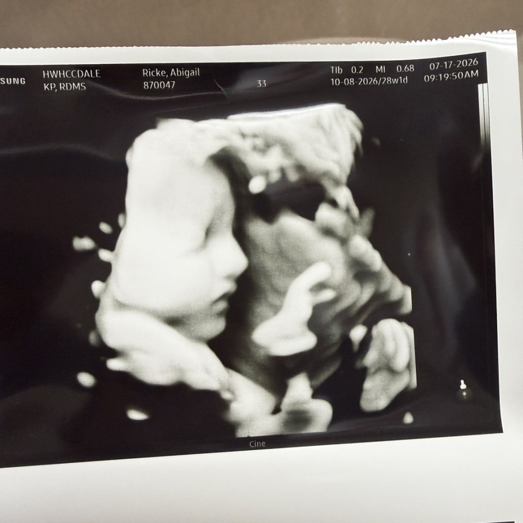 Photo shared by Abby for their Babylist baby registry.