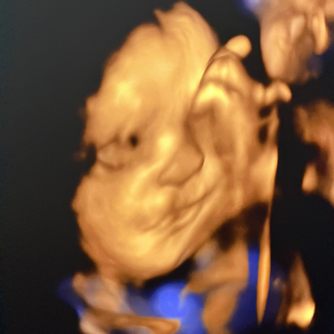 Photo shared by Jordan for their Babylist baby registry.