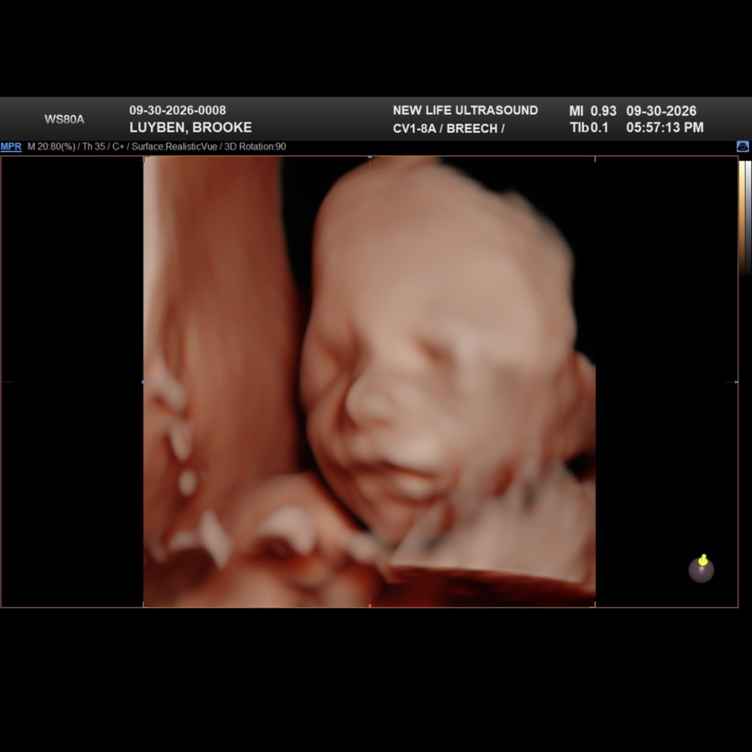 Photo shared by Brooke for their Babylist baby registry.