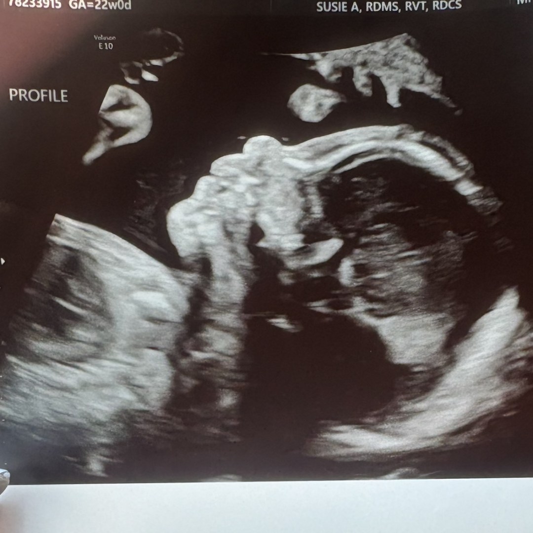 Photo shared by Cameron for their Babylist baby registry.