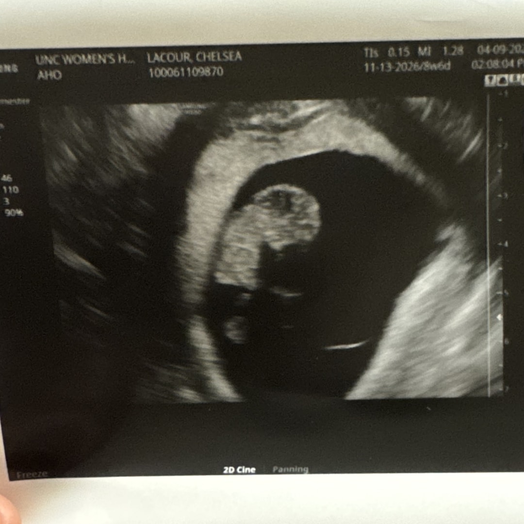 Photo shared by Chelsea for their Babylist baby registry.