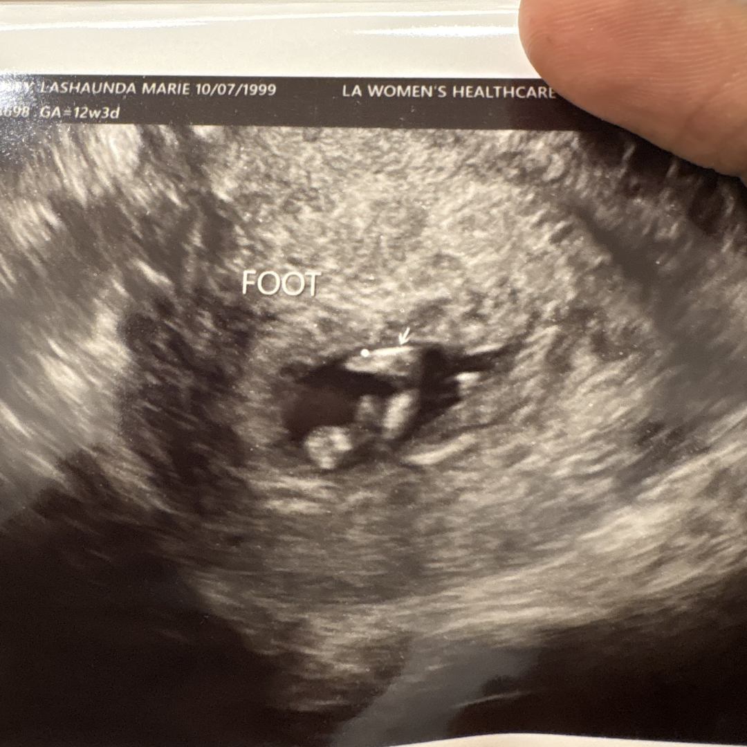Photo shared by Lashaunda for their Babylist baby registry.