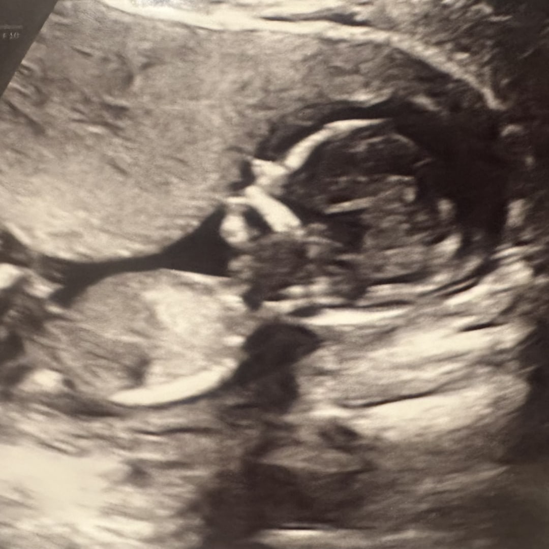 Photo shared by Brianna for their Babylist baby registry.