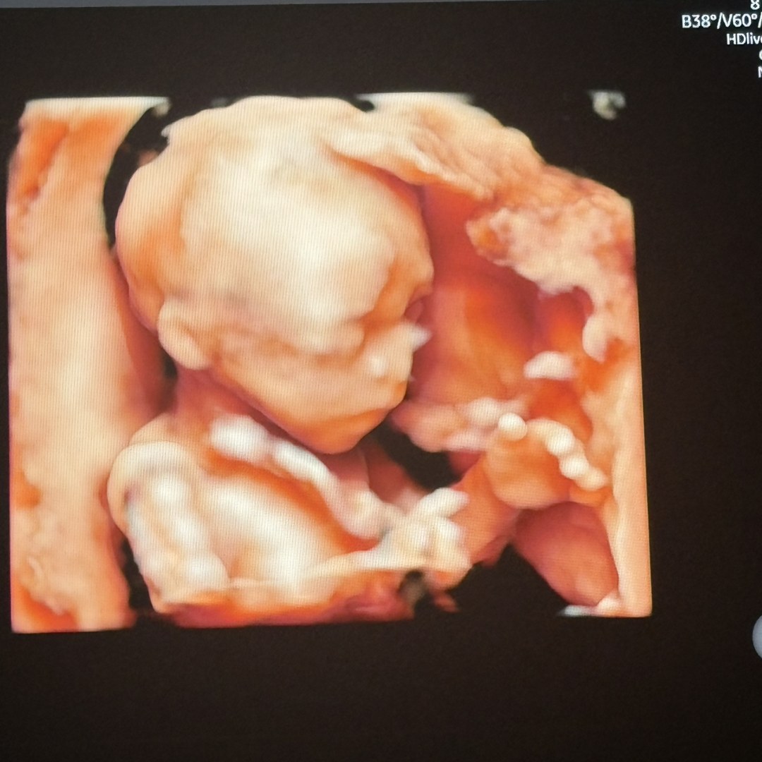 Photo shared by Nasira for their Babylist baby registry.