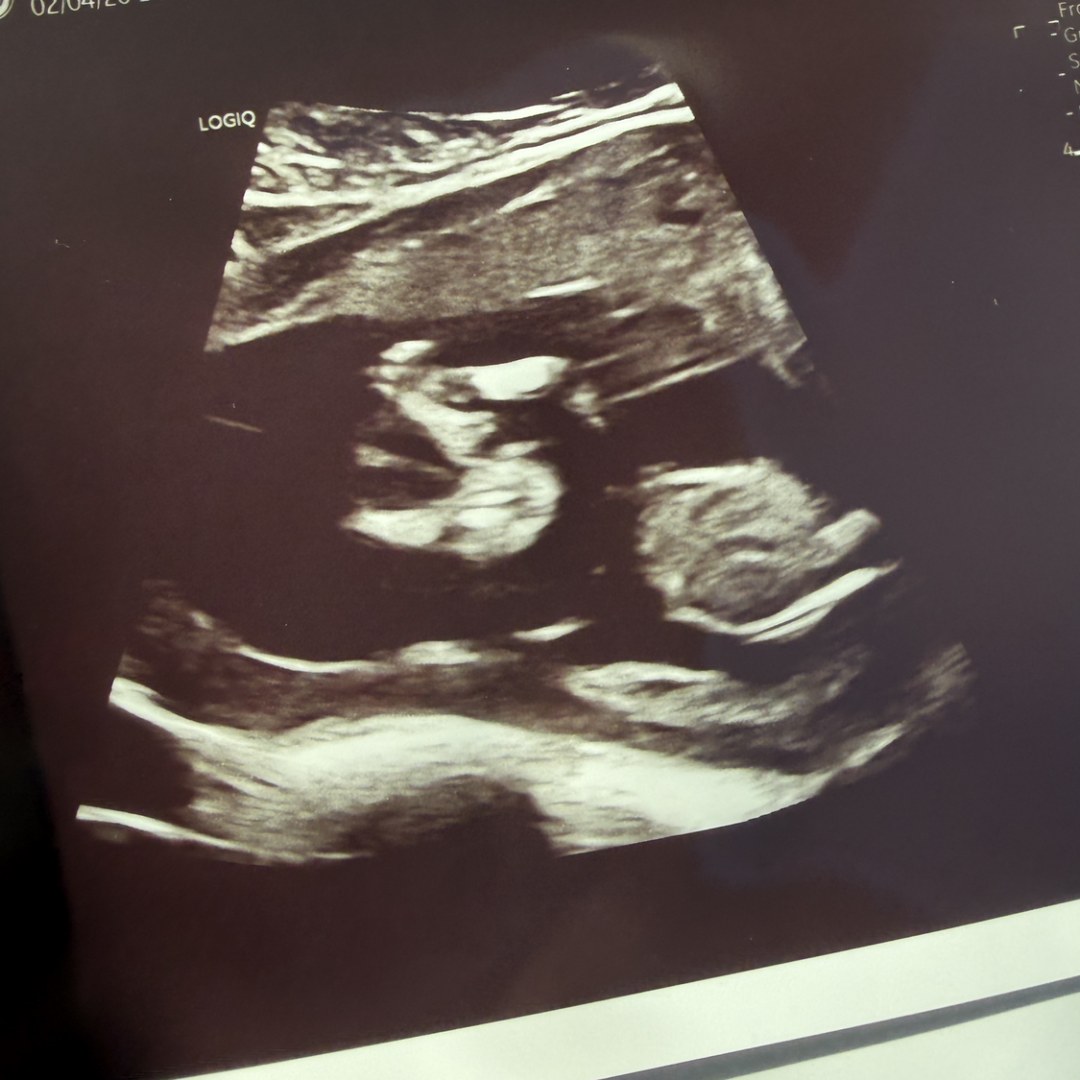 Photo shared by Colleen for their Babylist baby registry.