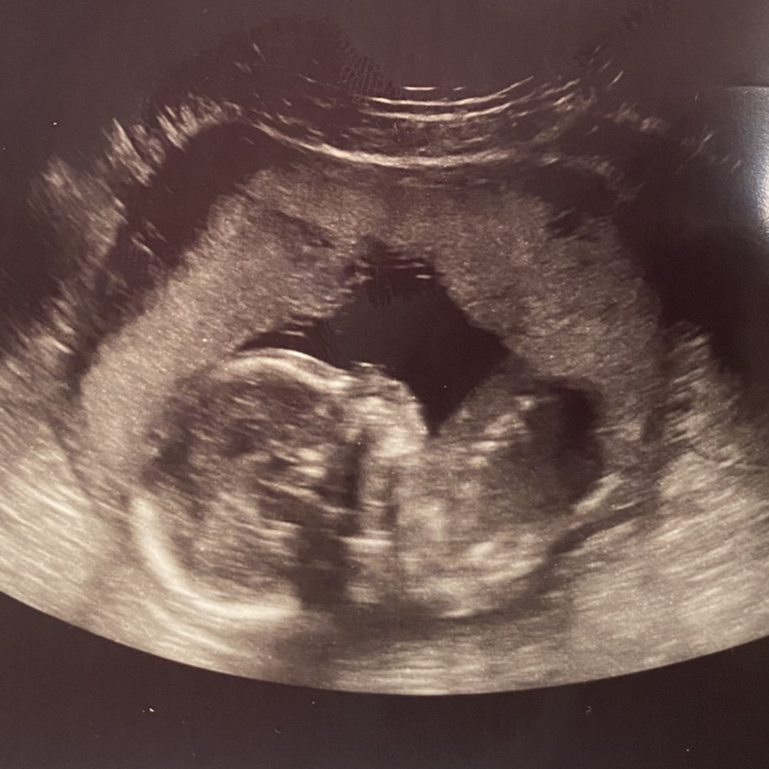 Photo shared by Roshayne for their Babylist baby registry.