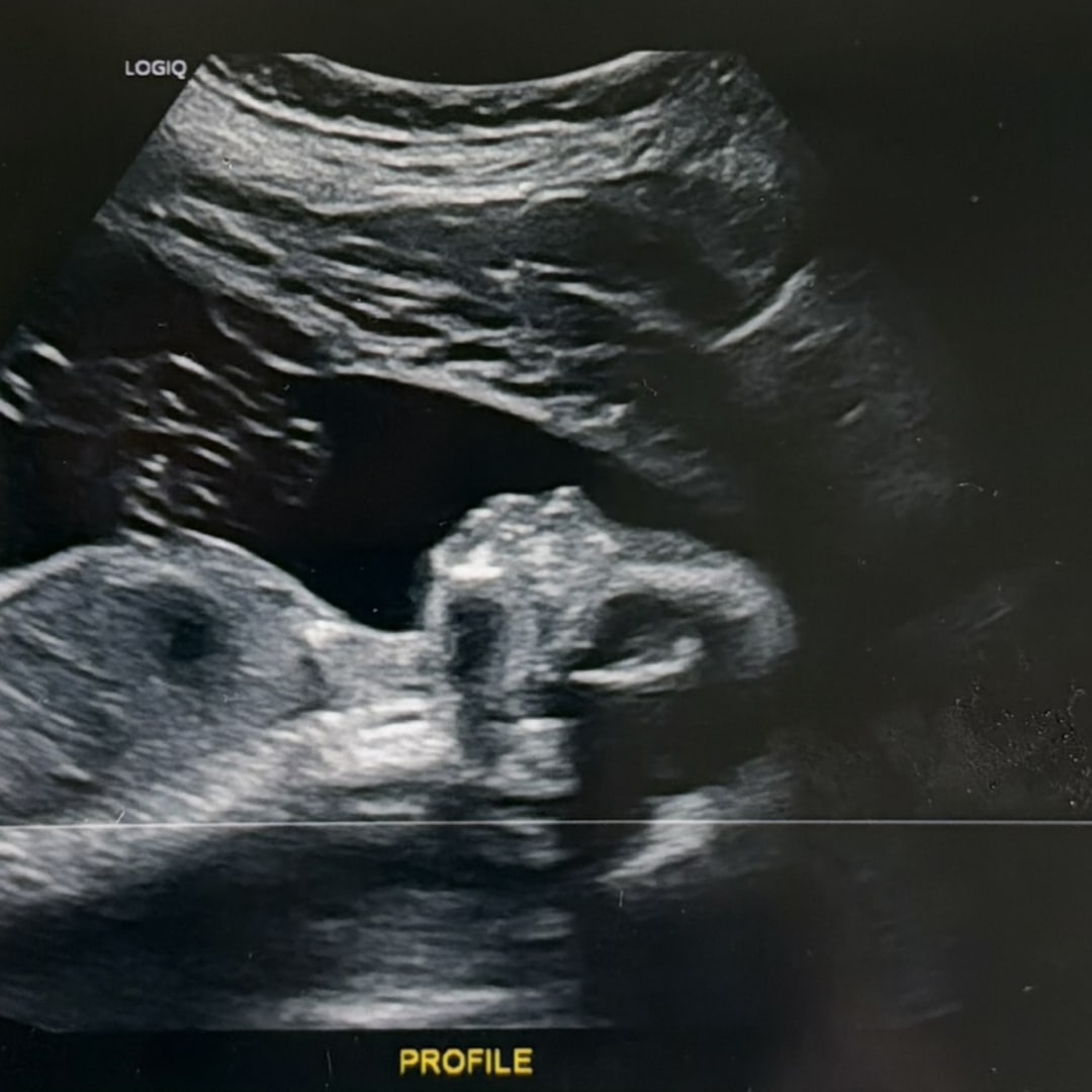 Photo shared by Rebekka for their Babylist baby registry.