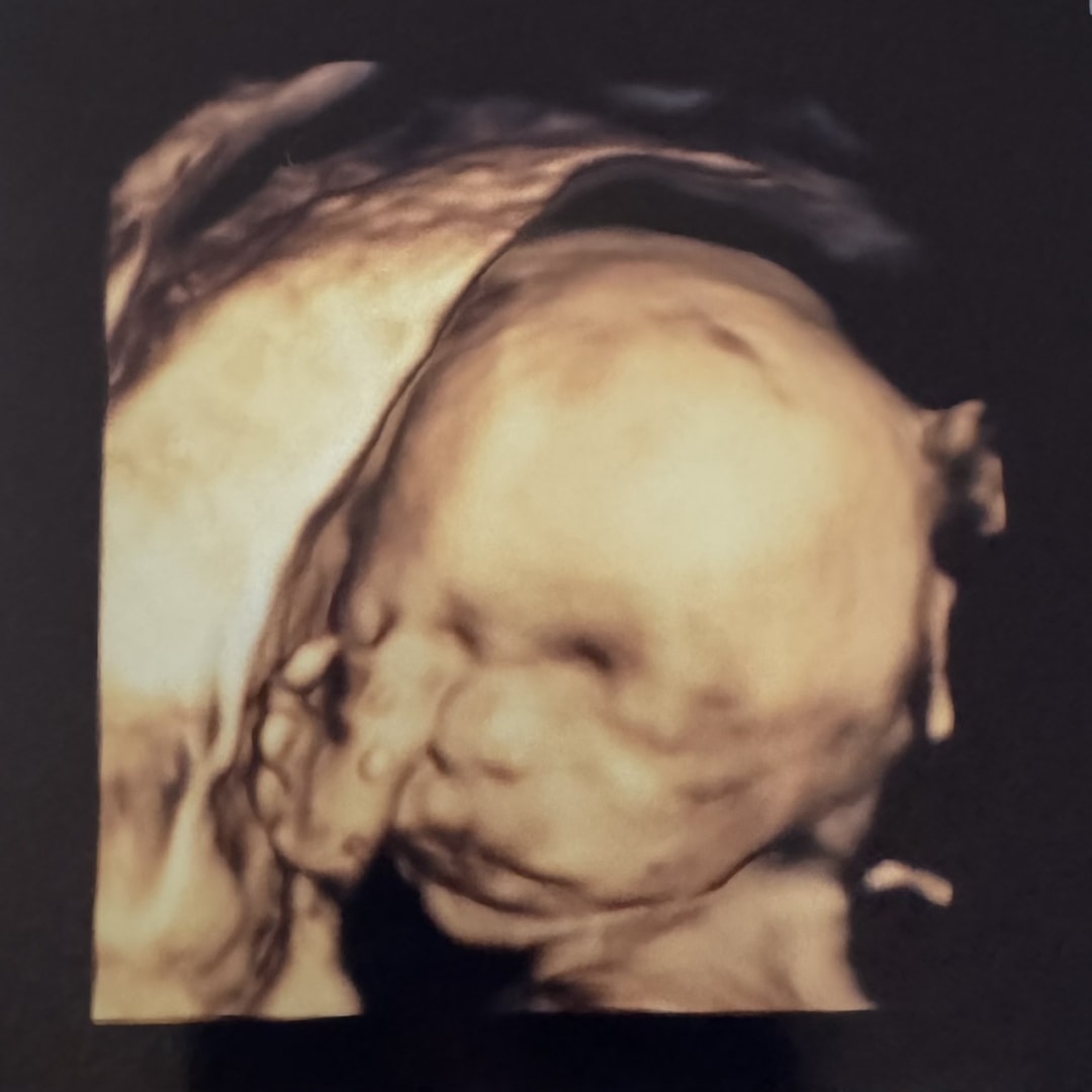 Photo shared by Alexis for their Babylist baby registry.