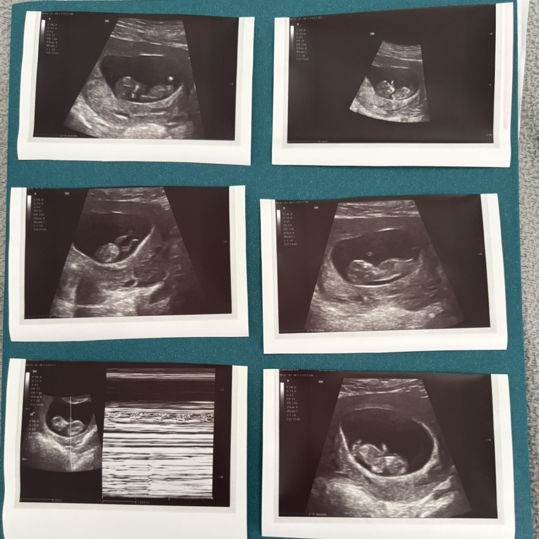 Photo shared by Sophie for their Babylist baby registry.