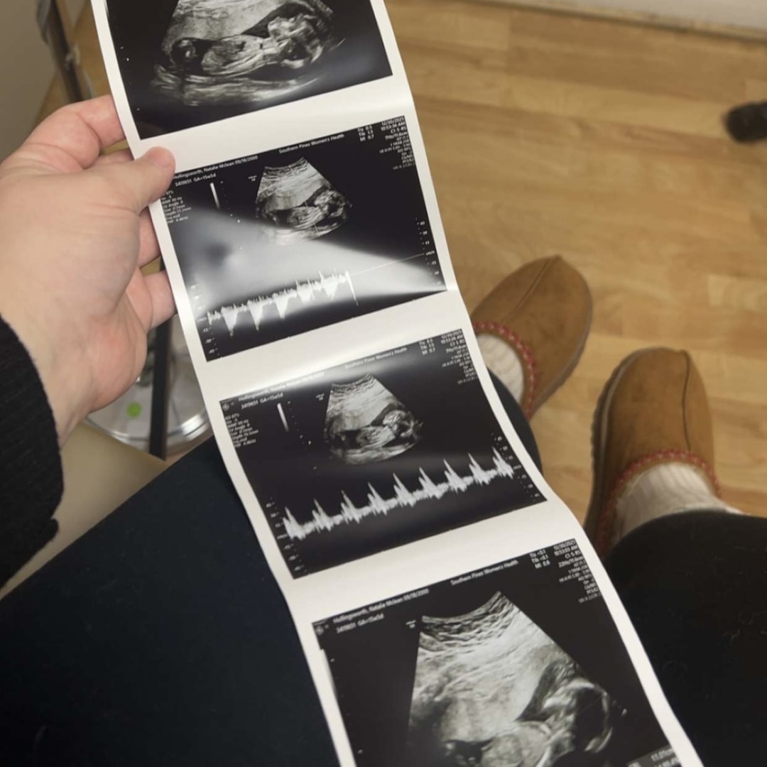 Photo shared by Natalie for their Babylist baby registry.