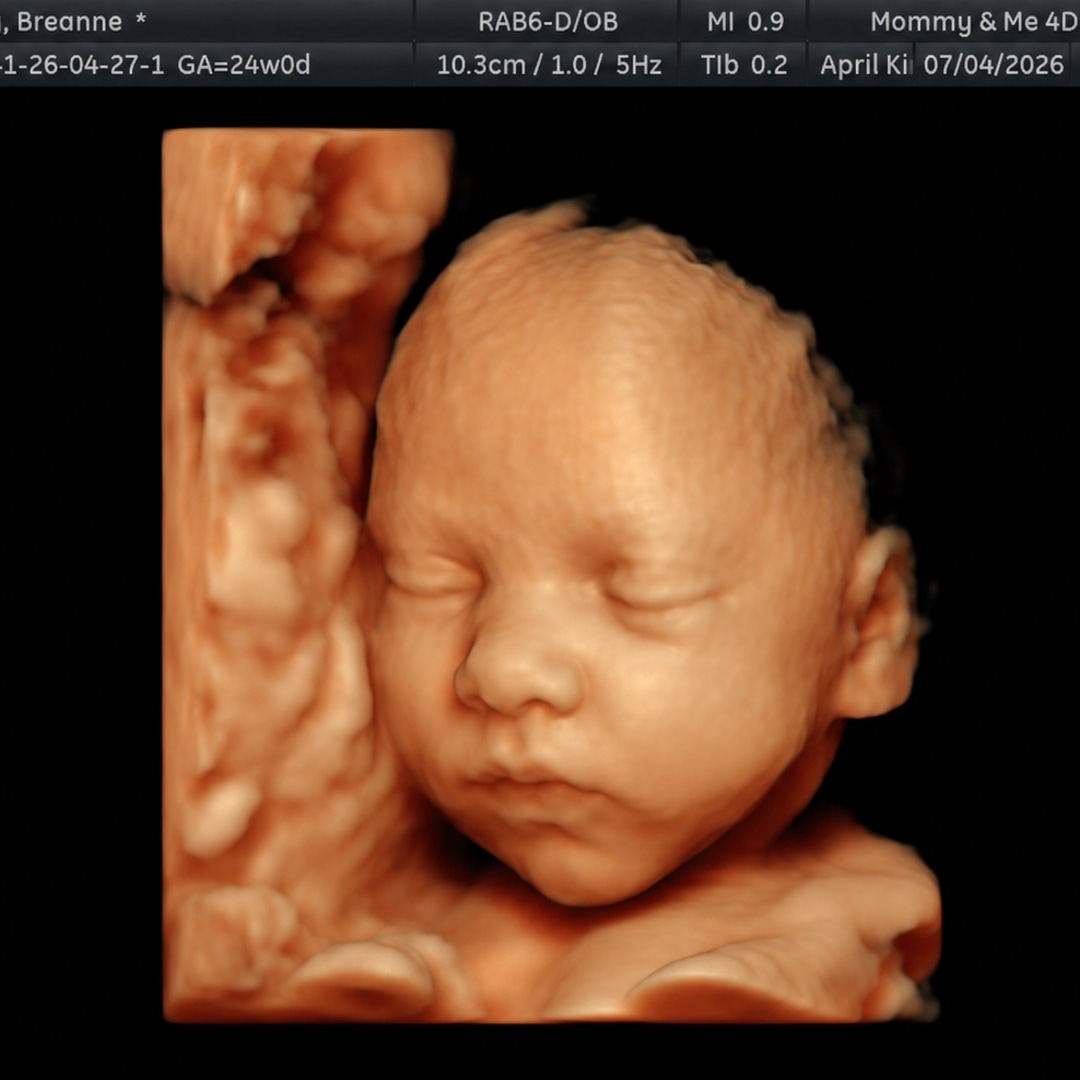 Photo shared by Breanne for their Babylist baby registry.