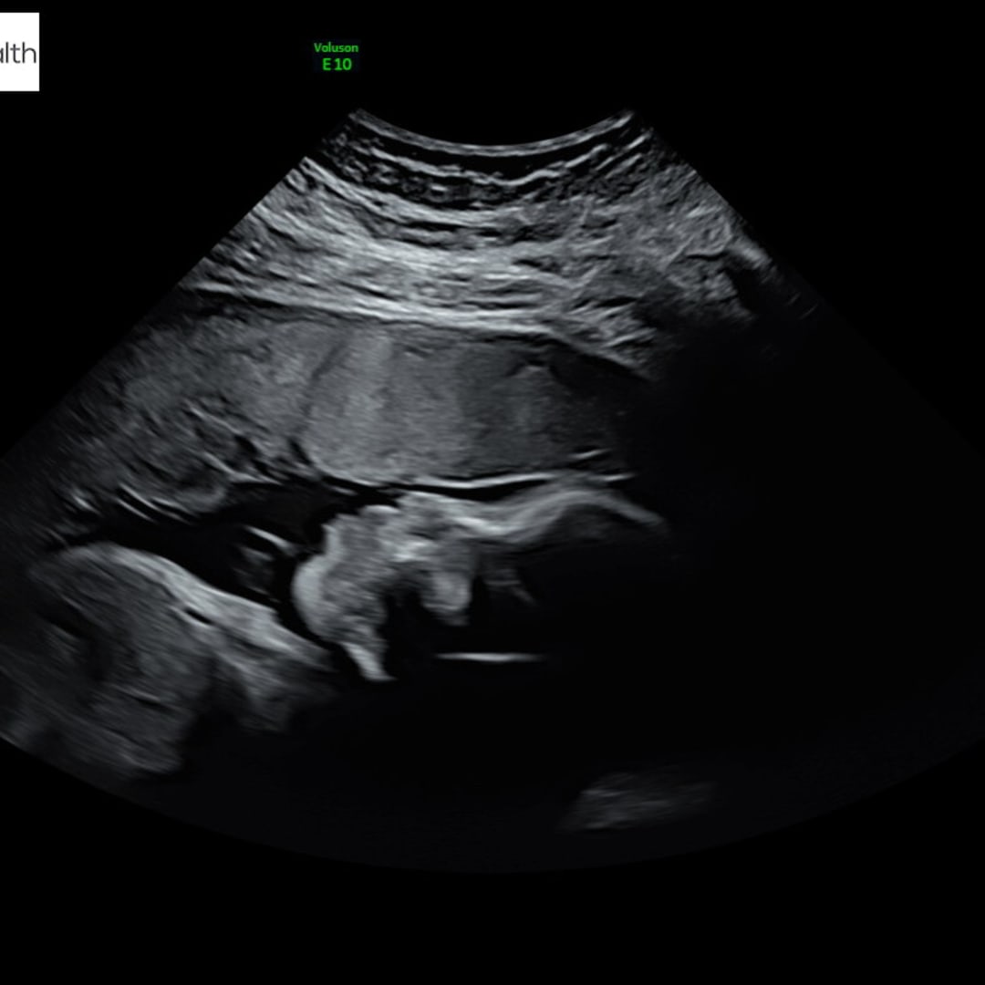 Photo shared by Sumarra for their Babylist baby registry.