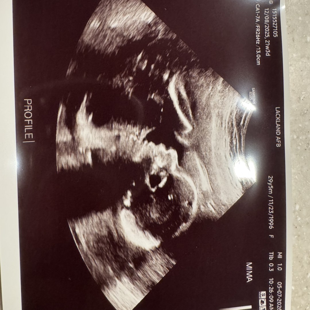 Photo shared by Rian for their Babylist baby registry.