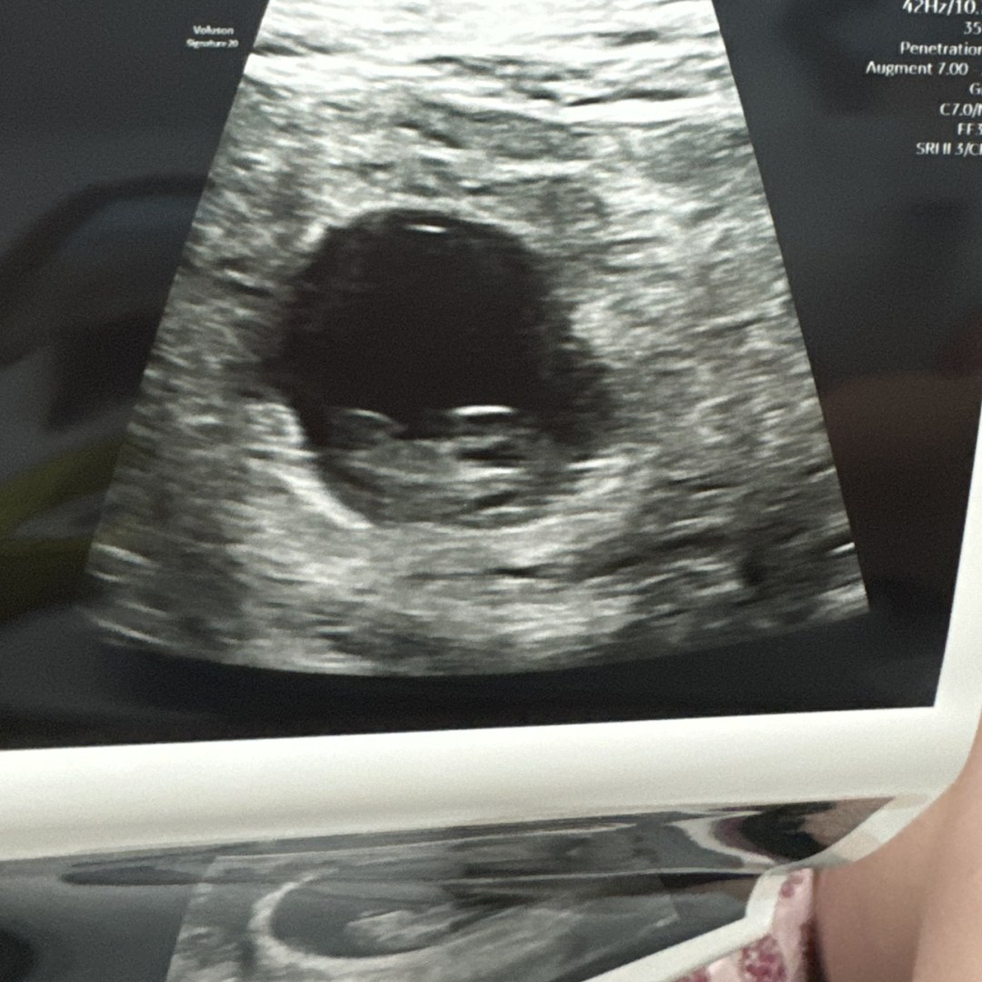 Photo shared by Megan for their Babylist baby registry.