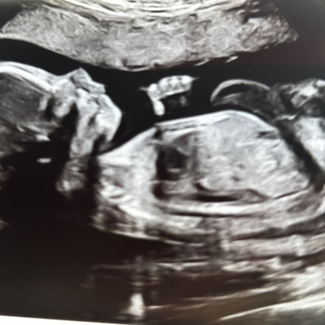 Photo shared by Christina for their Babylist baby registry.