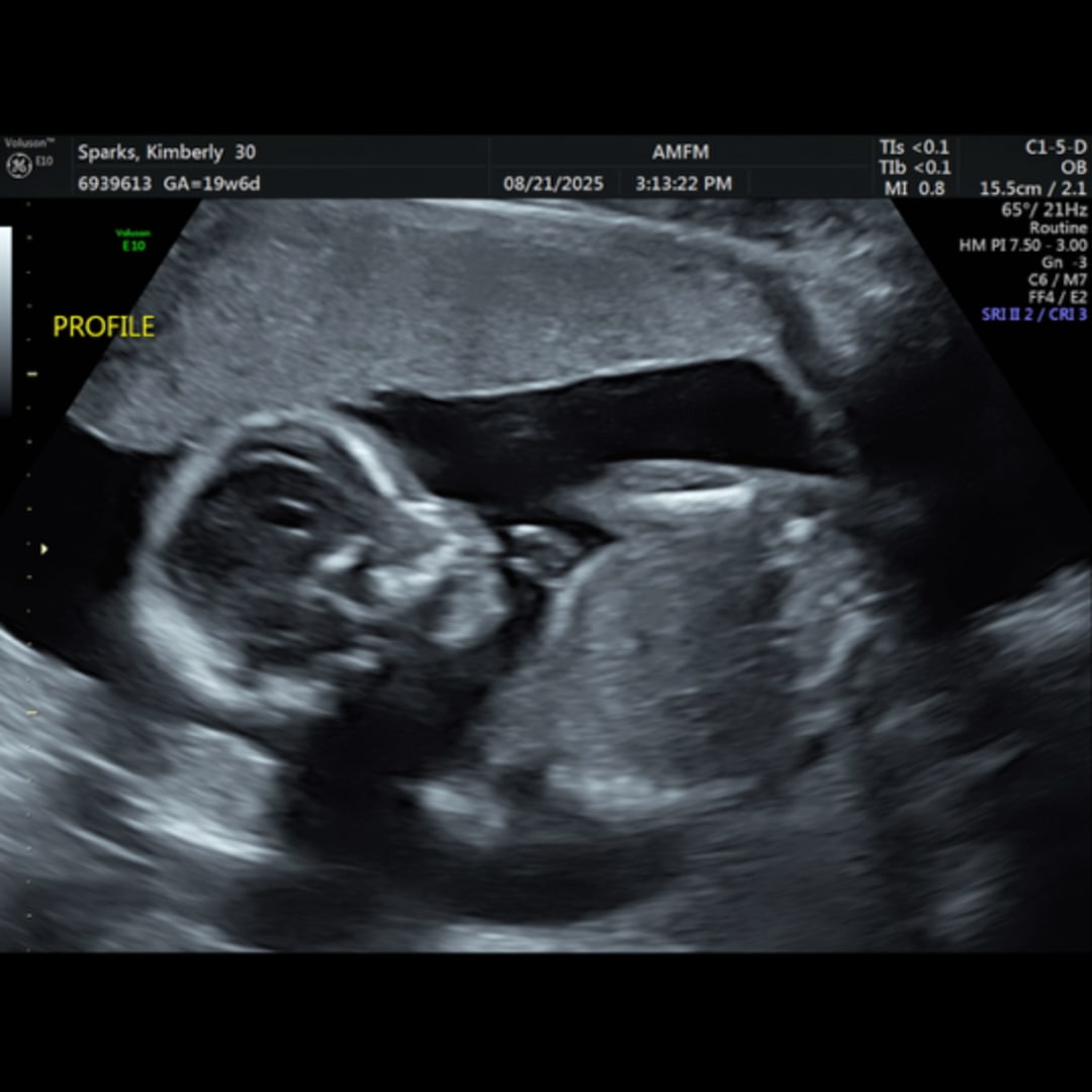 Photo shared by Kimberly for their Babylist baby registry.