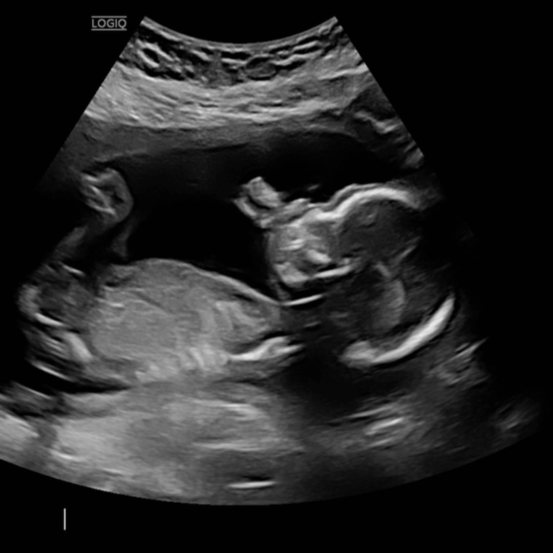 Photo shared by Lauryn for their Babylist baby registry.