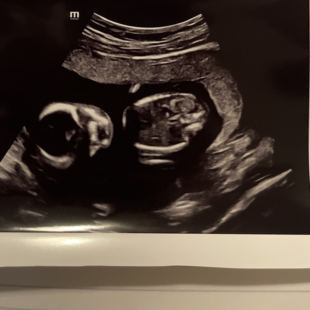 Photo shared by Katlyn for their Babylist baby registry.