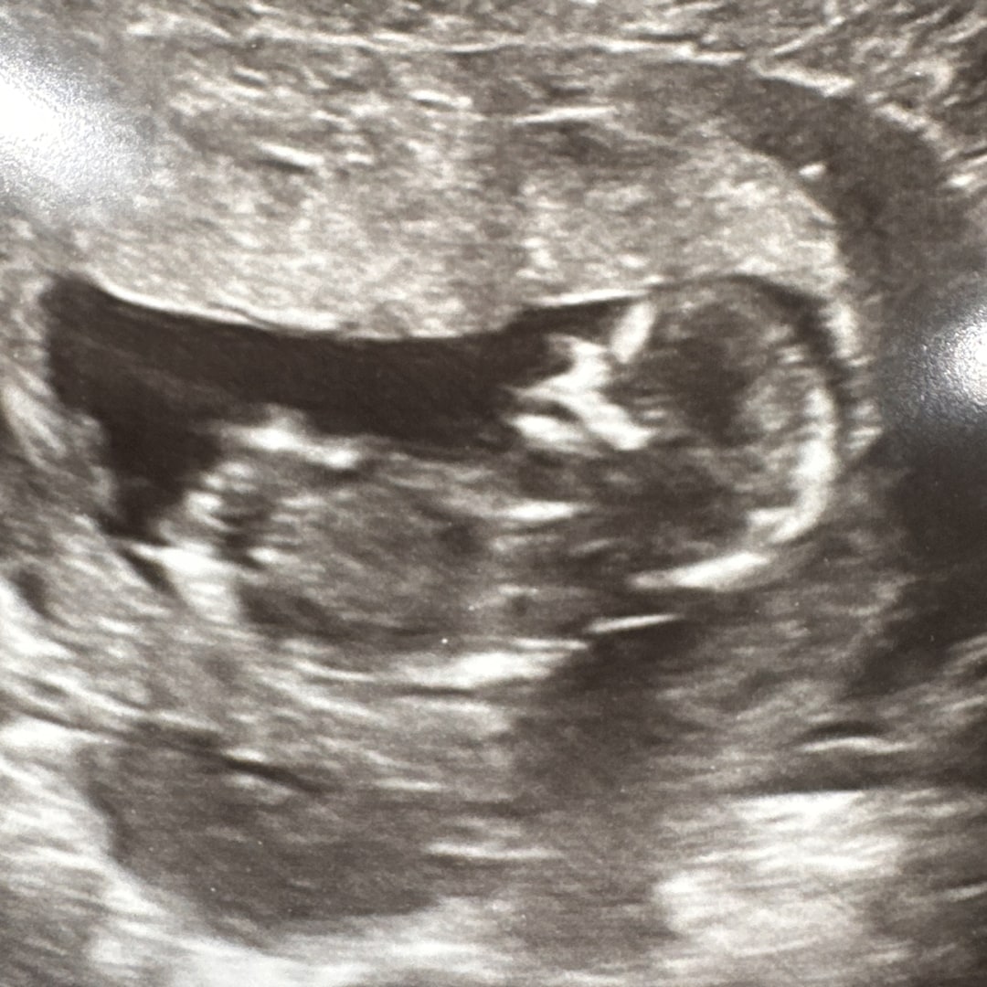 Photo shared by Lizbeth for their Babylist baby registry.