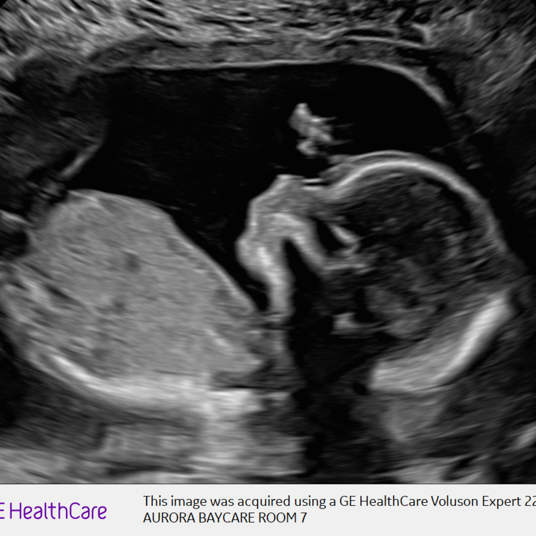 Photo shared by Ana for their Babylist baby registry.