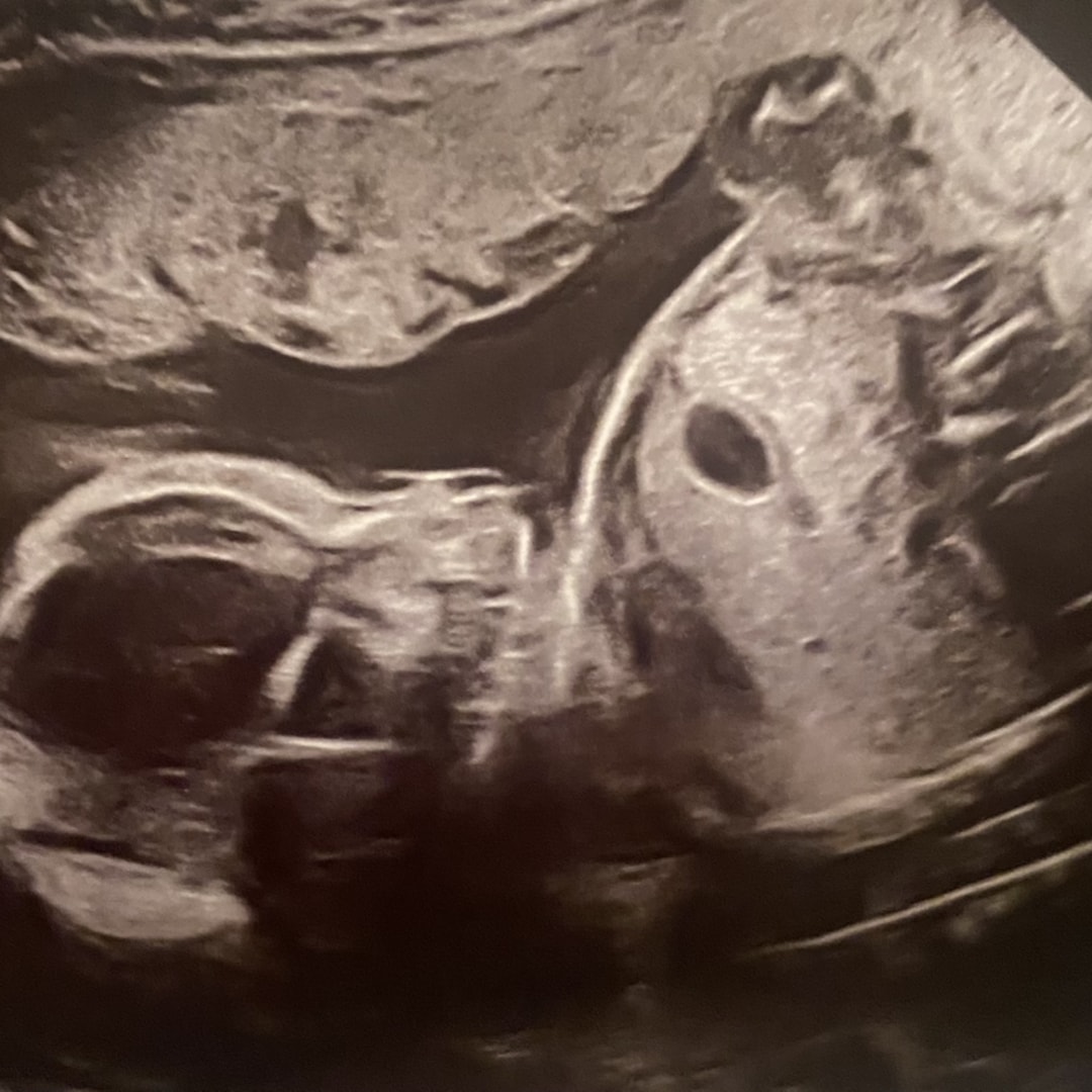 Photo shared by Teresa for their Babylist baby registry.