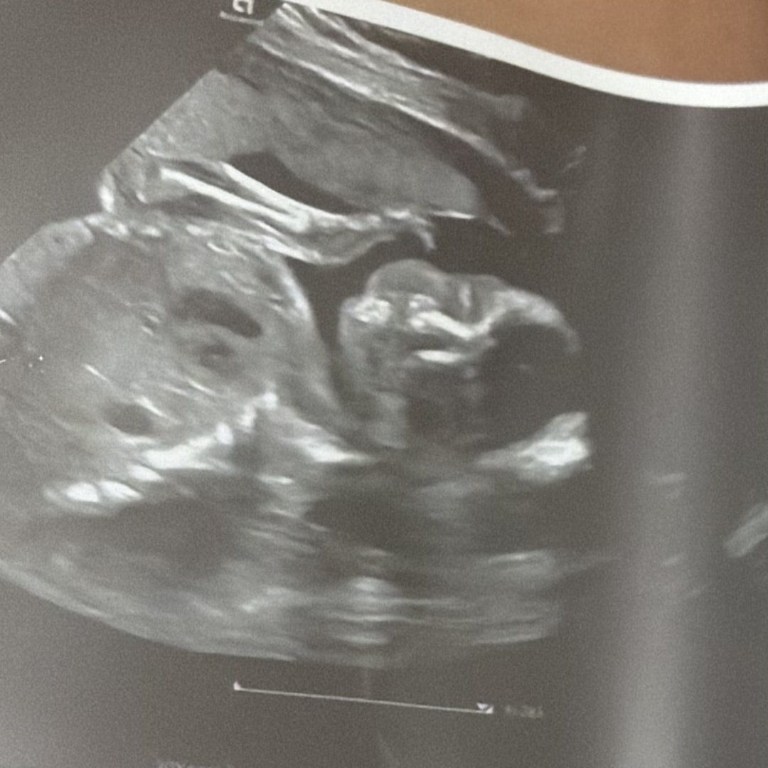Photo shared by Jayla for their Babylist baby registry.
