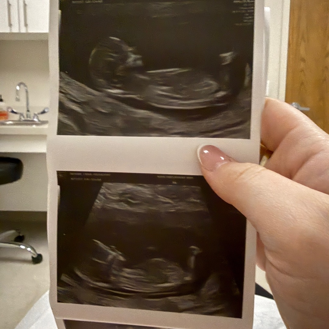 Photo shared by Annie for their Babylist baby registry.