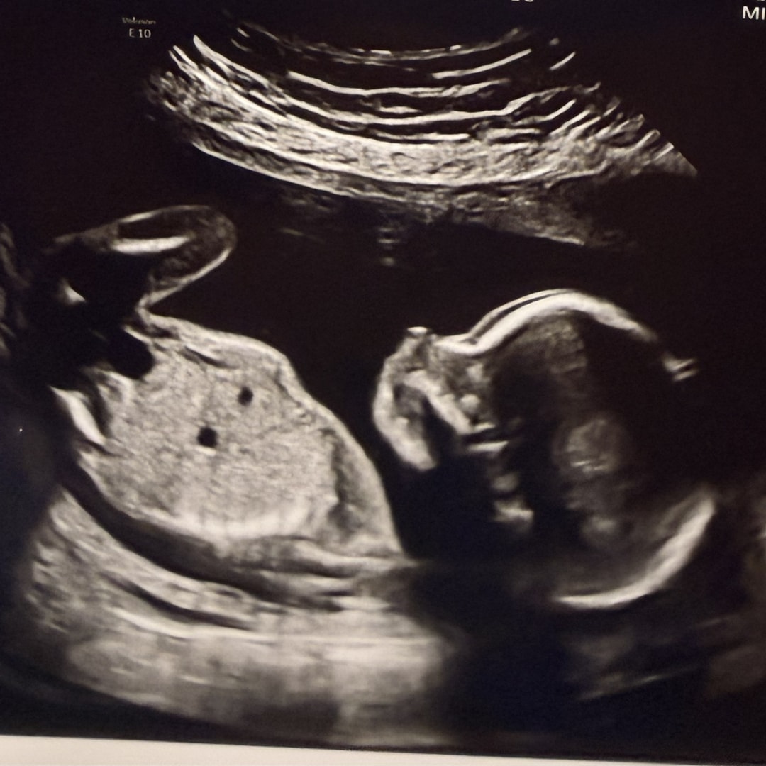 Photo shared by Heather for their Babylist baby registry.