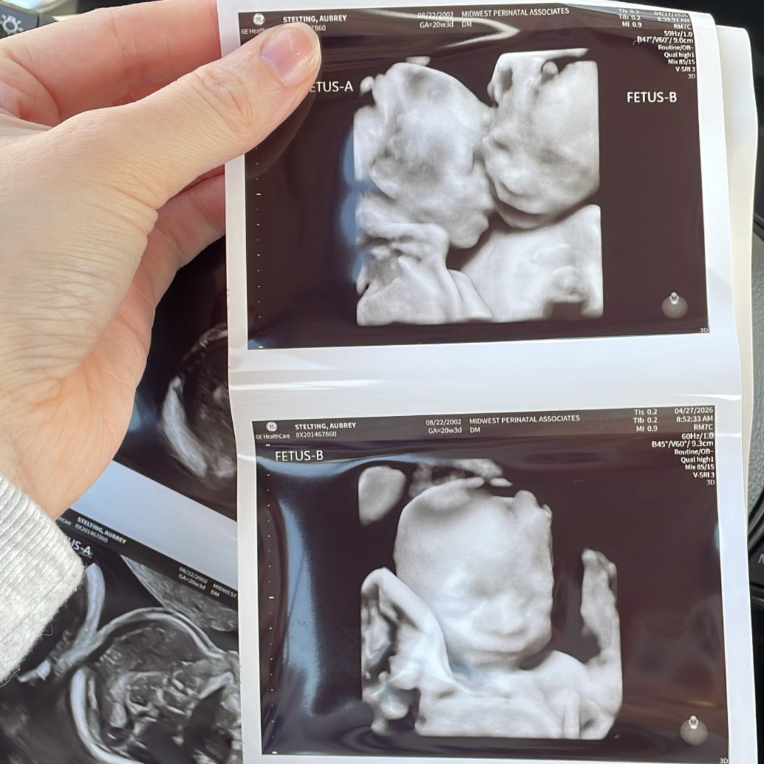 Photo shared by Aubrey for their Babylist baby registry.