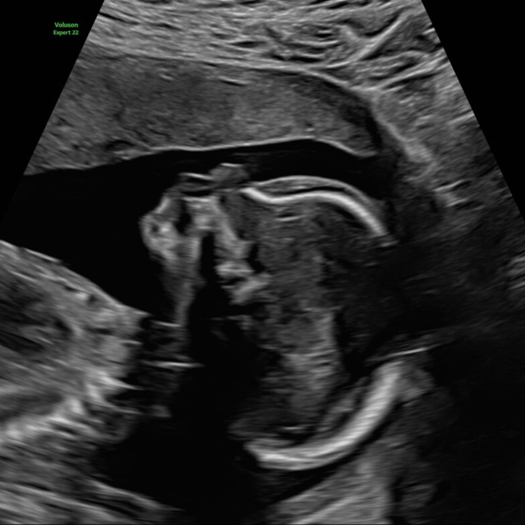 Photo shared by Alison for their Babylist baby registry.