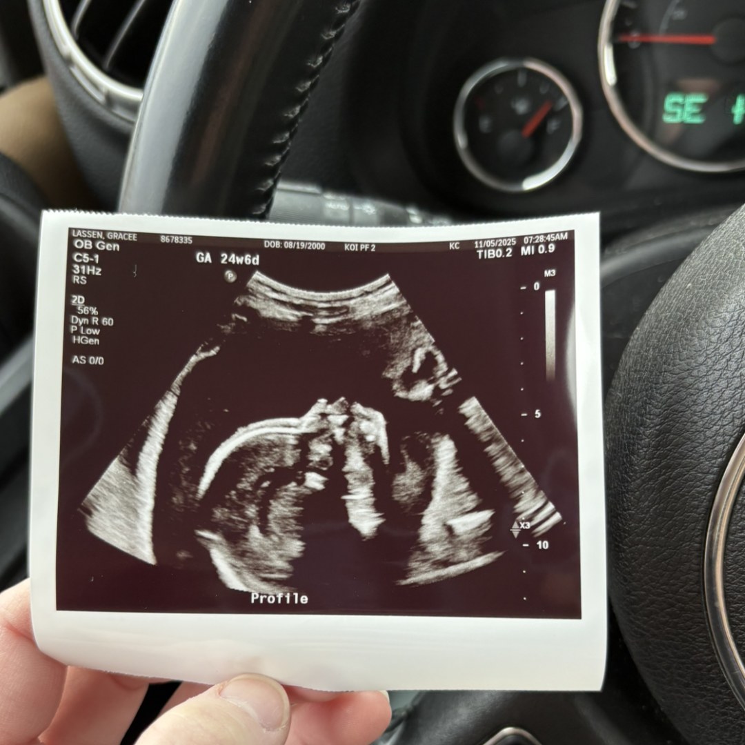 Photo shared by Gracee for their Babylist baby registry.