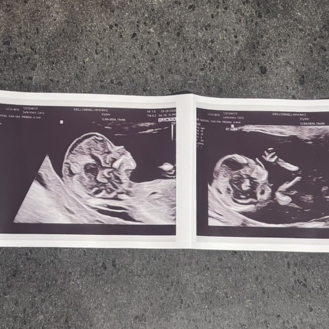 Photo shared by Carly for their Babylist baby registry.