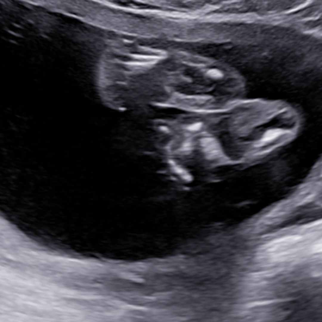 Photo shared by Autumn for their Babylist baby registry.