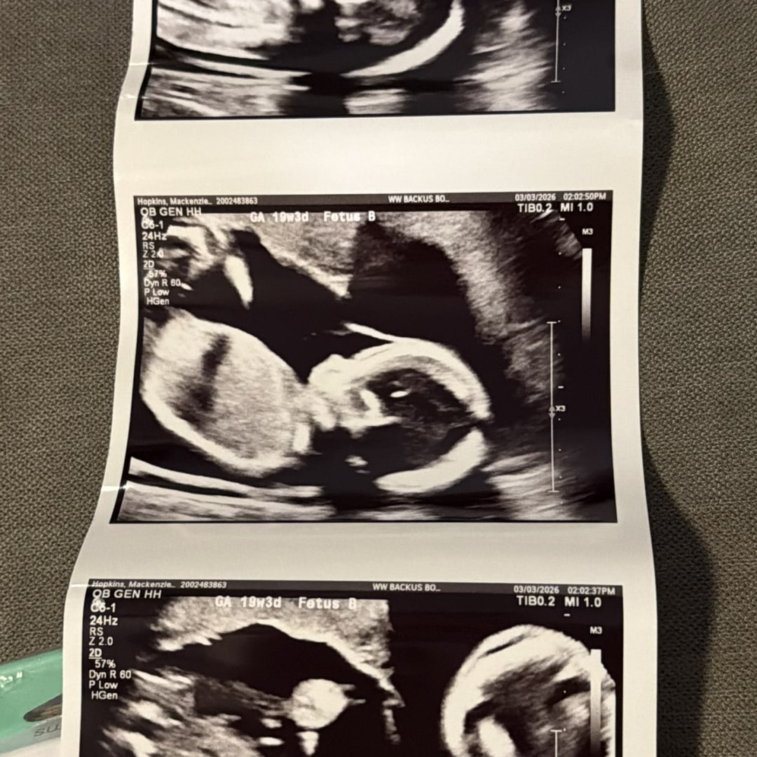 Photo shared by Mackenzie for their Babylist baby registry.