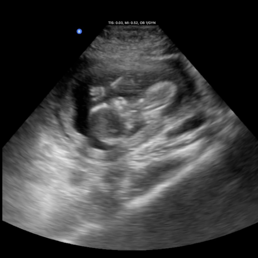 Photo shared by Sierra for their Babylist baby registry.