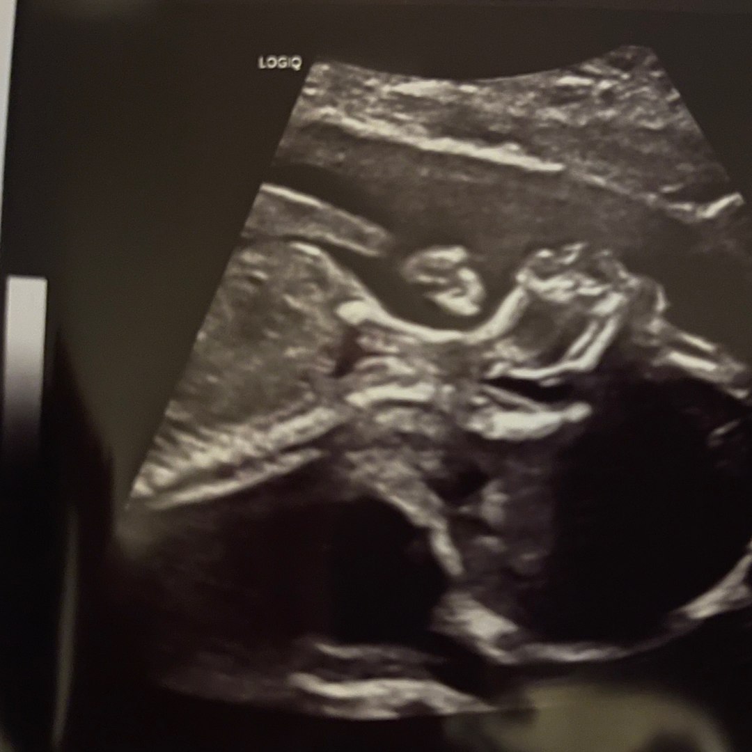 Photo shared by Andrea for their Babylist baby registry.