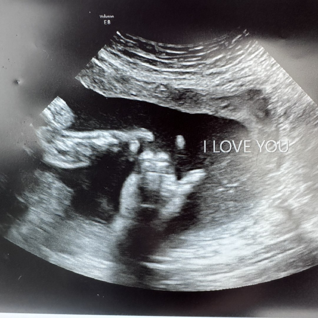 Photo shared by Erika for their Babylist baby registry.