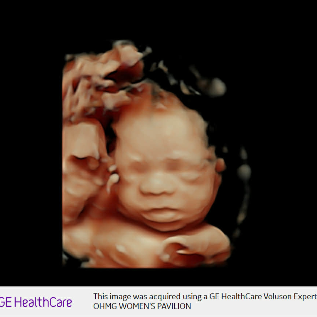 Photo shared by Emily for their Babylist baby registry.