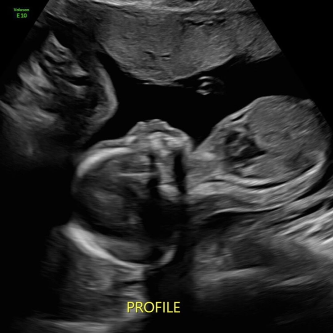 Photo shared by Adelina for their Babylist baby registry.
