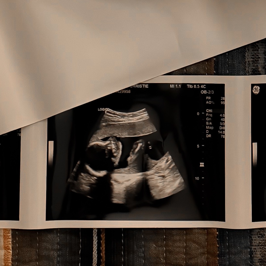 Photo shared by Christie for their Babylist baby registry.