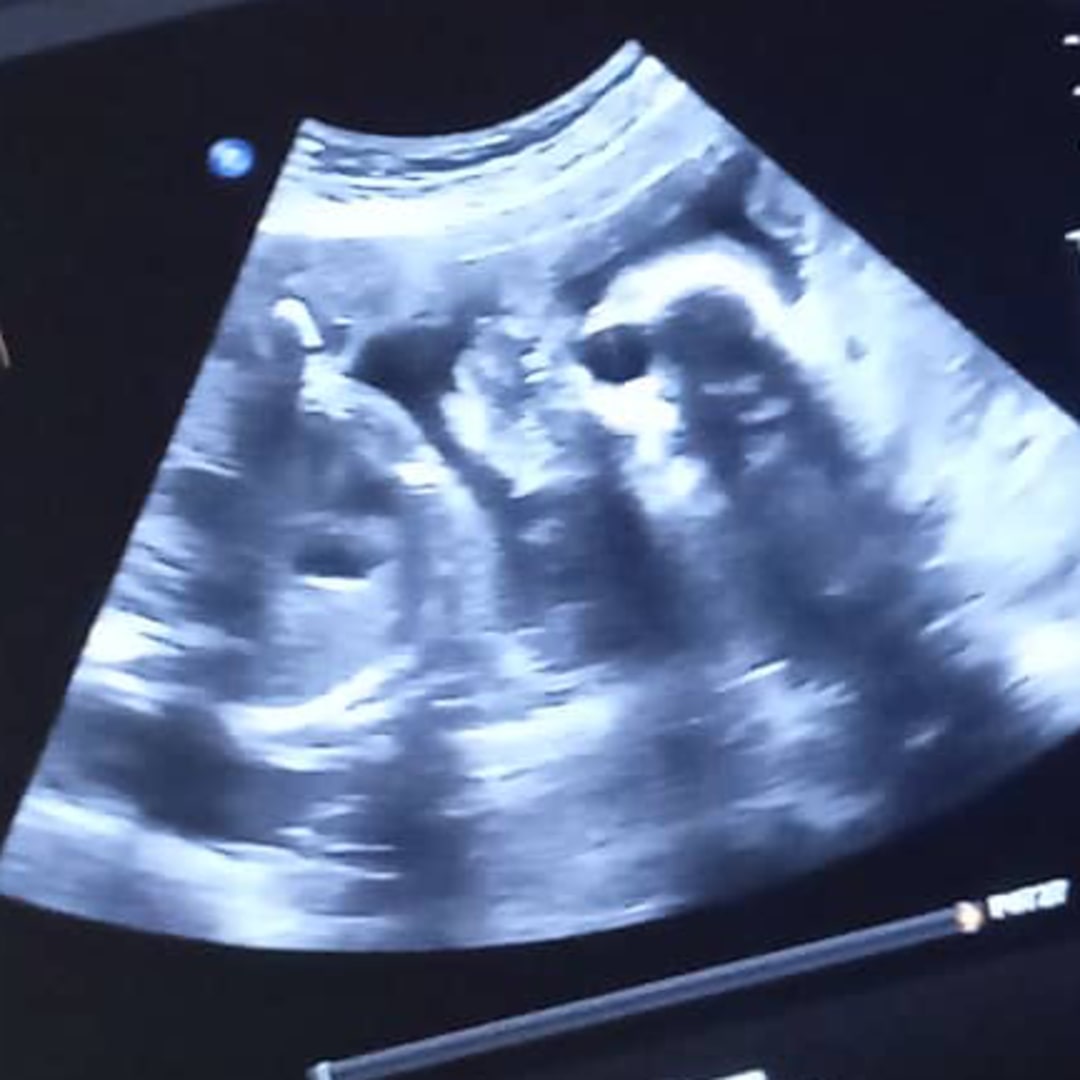 Photo shared by Lisandra for their Babylist baby registry.