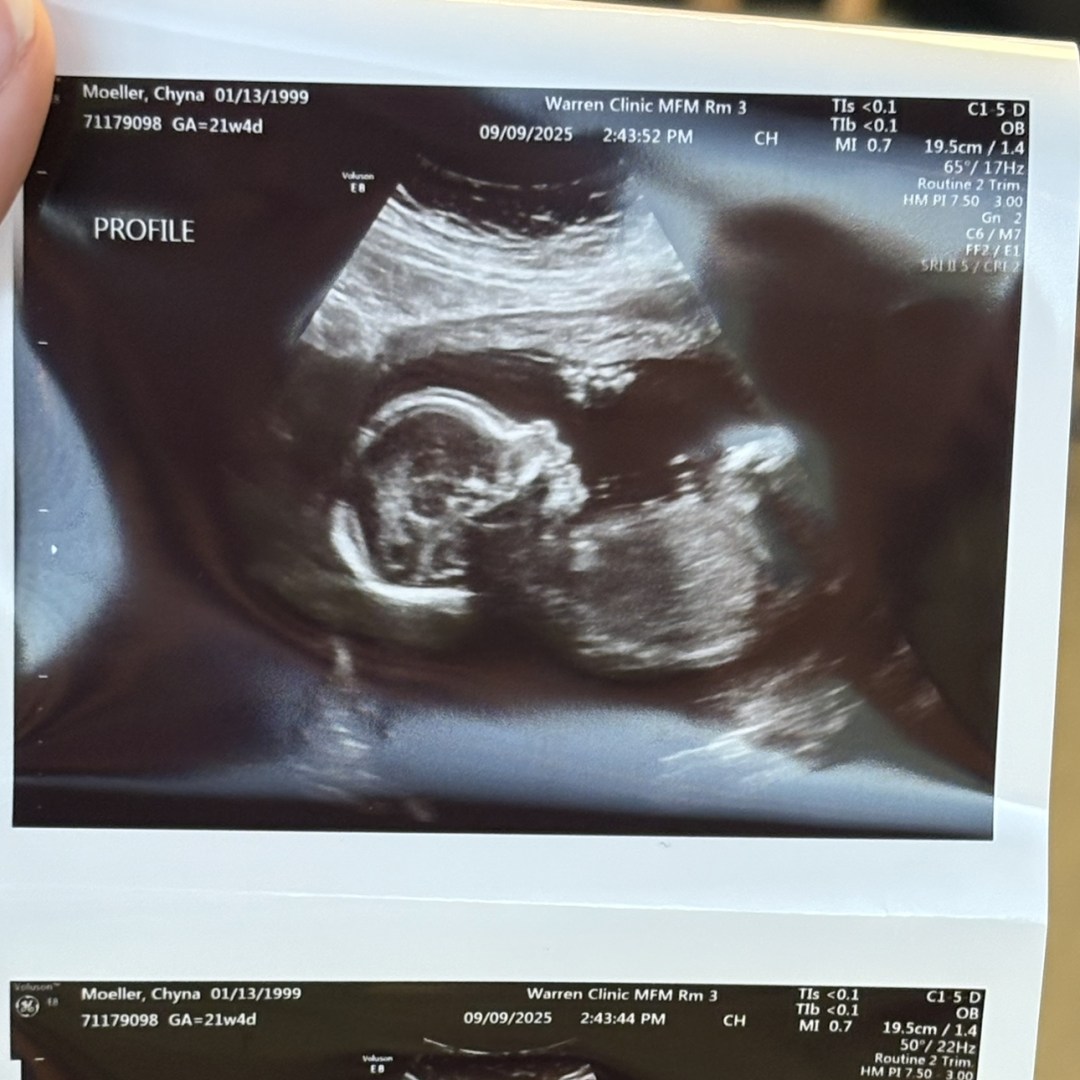 Photo shared by Chyna for their Babylist baby registry.