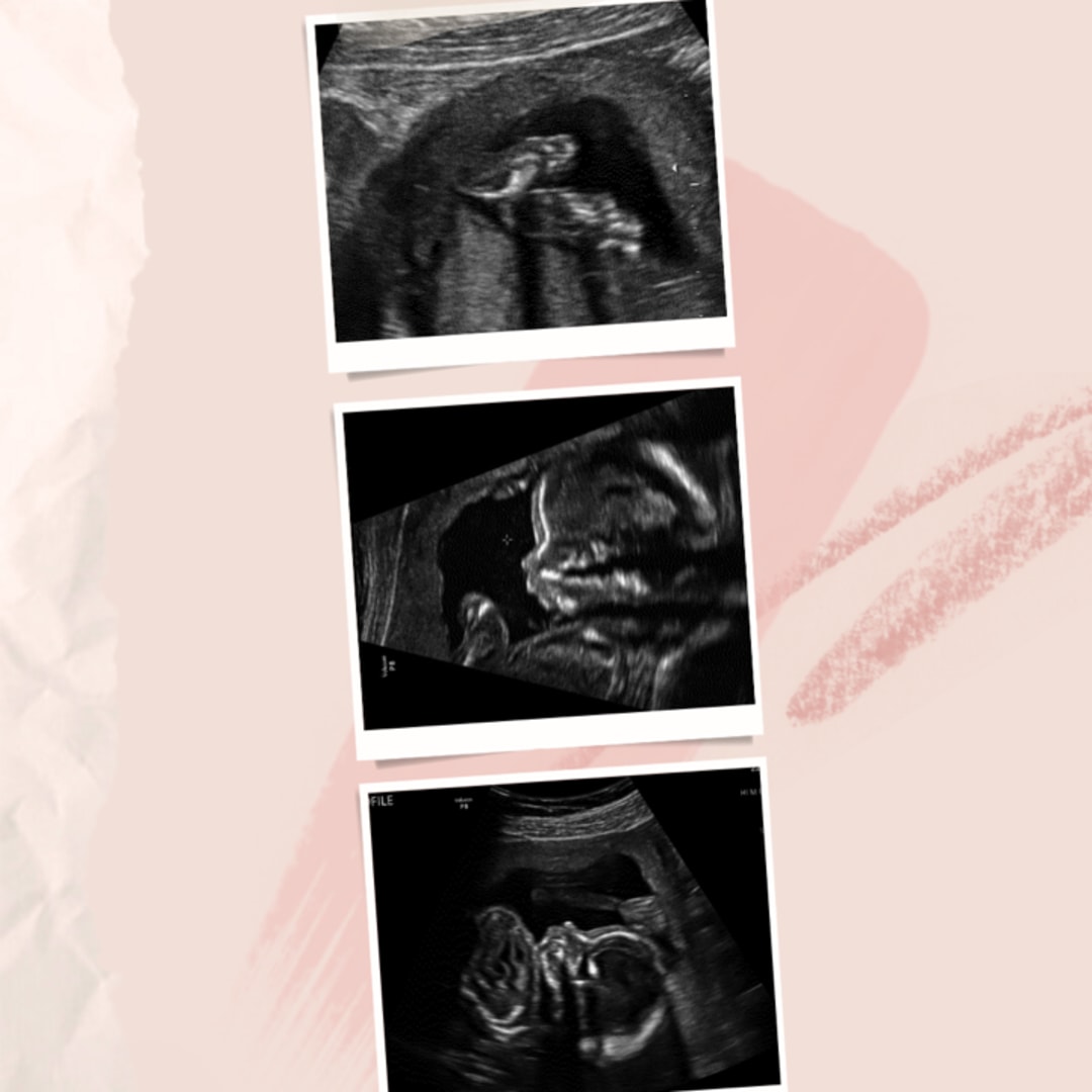 Photo shared by Jacob for their Babylist baby registry.