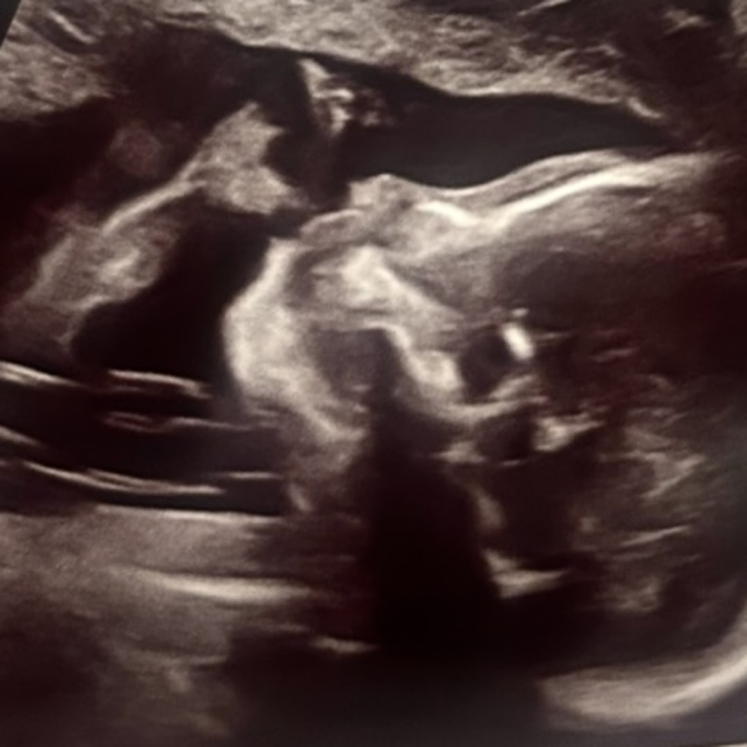 Photo shared by Allie for their Babylist baby registry.