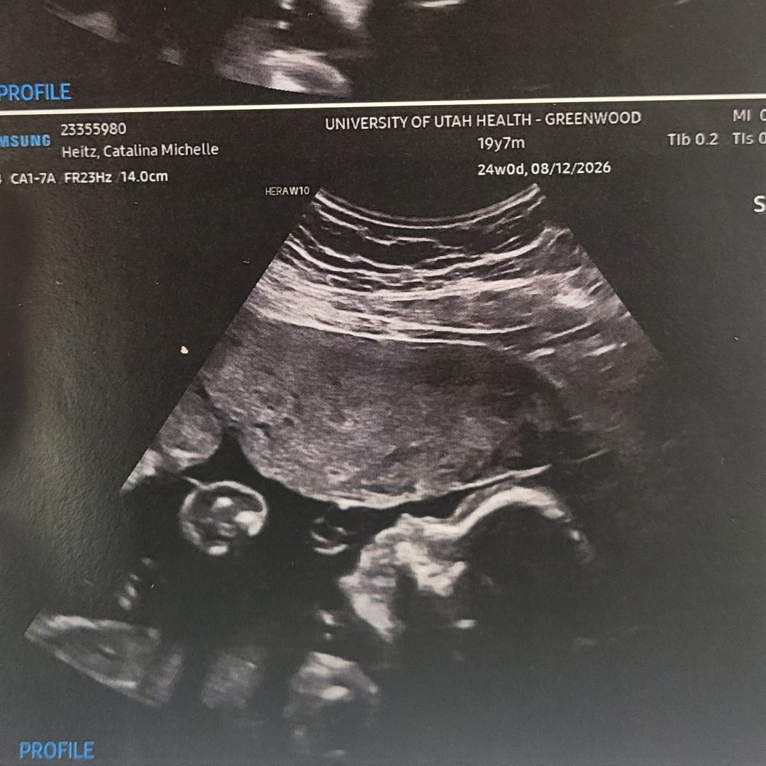Photo shared by Catalina for their Babylist baby registry.