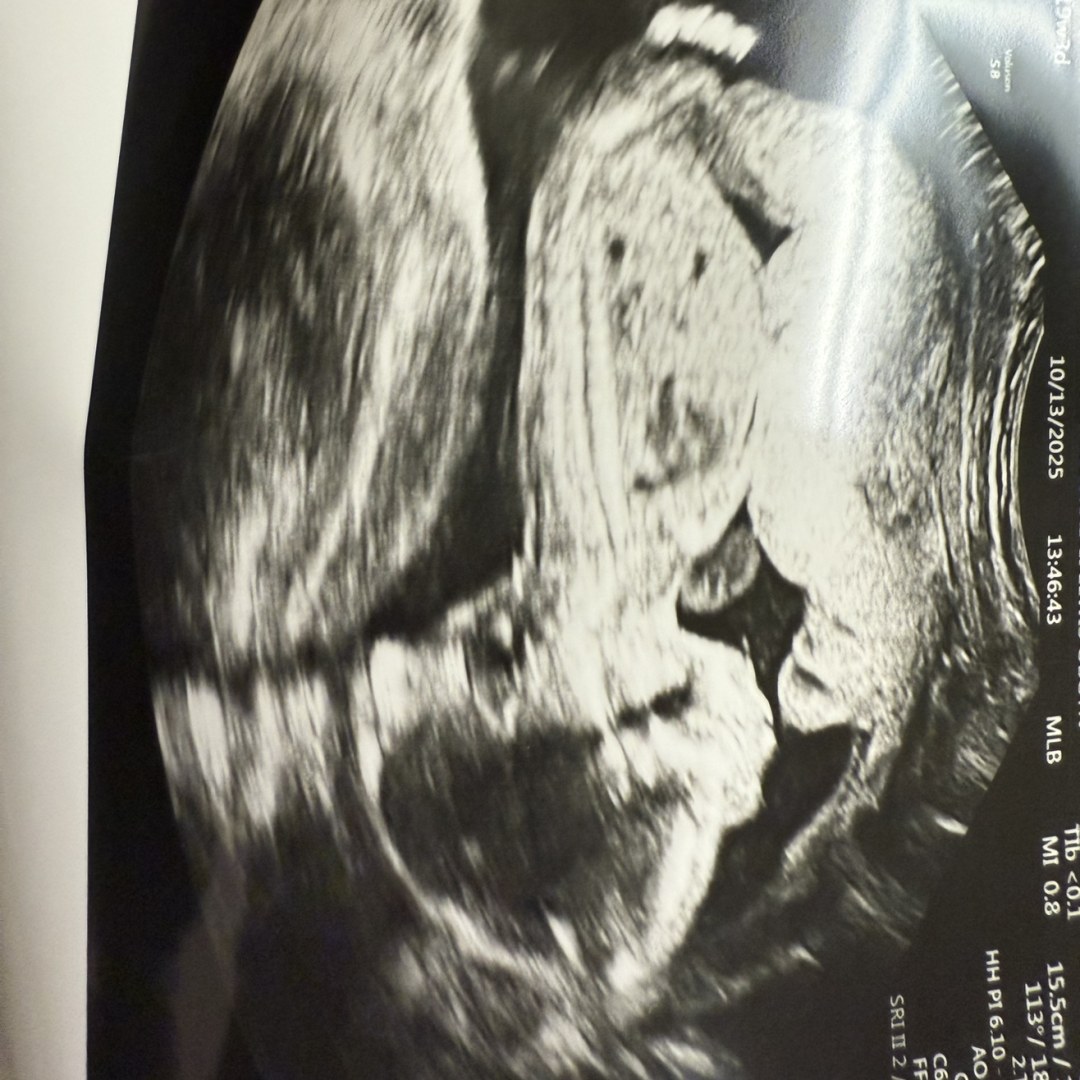 Photo shared by D’Karra for their Babylist baby registry.