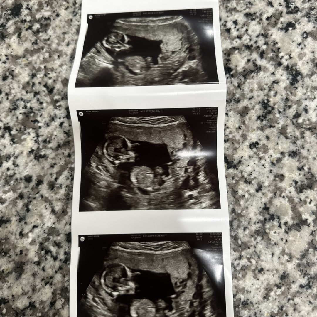 Photo shared by Kelsey for their Babylist baby registry.